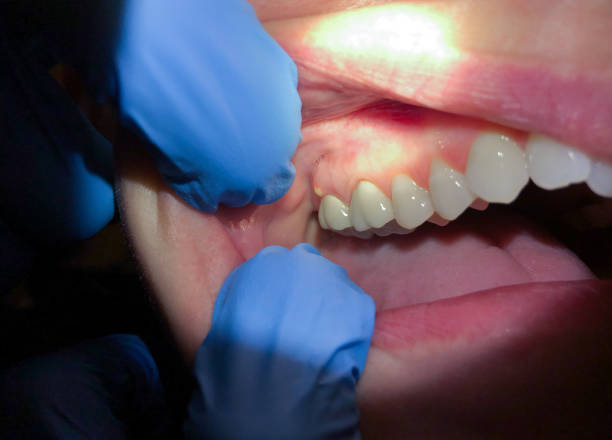 Best Holiday Emergency Dentist in Buckhead Ridge, FL